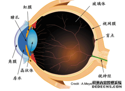 義眼適合什么樣的患者？