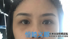 現(xiàn)如今高分子材料除了應(yīng)用于義眼外，還應(yīng)用與