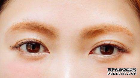 配戴義眼需要知道的問題