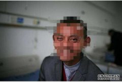 <b>義眼安裝后還會(huì)出現(xiàn)后遺癥嗎？</b>